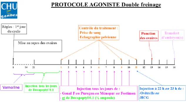 Figure 14 : Protocole agoniste double freinage 