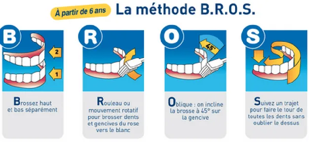 Figure 5 : La méthode B.R.O.S. 