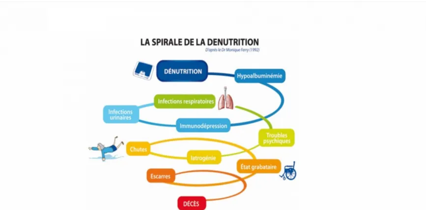 Figure 1: Spirale de la dénutrition du Dr Monique Ferry