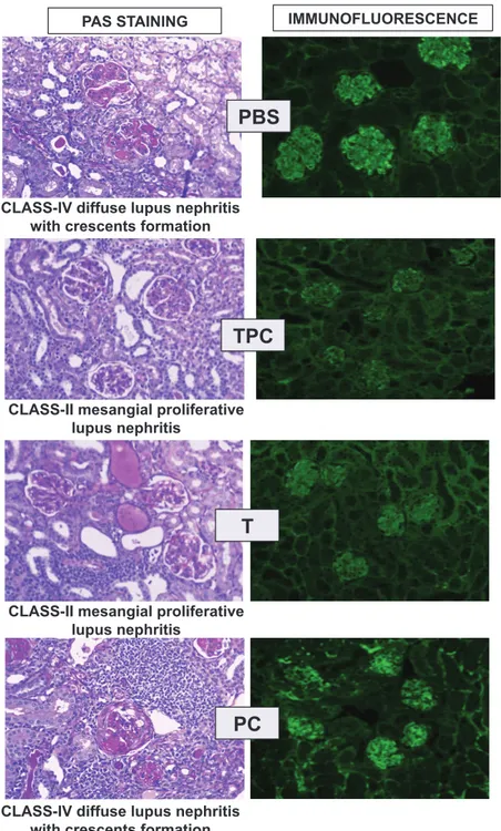 Figure 1b: TPC effects on glomerulonephritis development in  NZBxW/F1 lupus prone mice