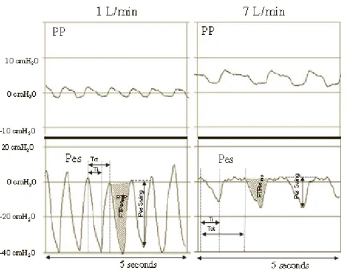 Figure 2. Variation des pressions pharyngienne et œsophagienne en fonction du débit de gaz 