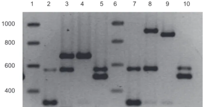 Fig. 1. Multiplex PCR-amplified fragments of four reference strains (PAO1: lanes 2 and 7, 7NSK2: lanes 3 and 8, ATCC 27853: lanes 4 and 9, and 59.20: lanes 5 and 10) with two different primer sets, electrophoretically separated