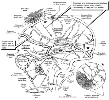 Figure  2  –  Drainage  veineux  cortical alternatif en l’absence  de  veines  corticales  superficielles  efficaces