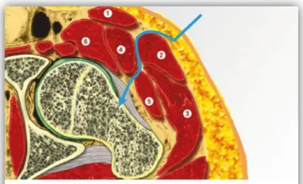 Figure    13   :    décubitus    dorsal    sans    table    orthopédique,    les    deux    membres    inférieurs    sont    dans   le   champ   opératoire