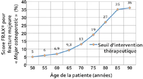 Figure 3 : seuil d’intervention en fonction de la valeur du FRAX® pour fracture majeure  de l’ostéoporose selon l’âge pour la France 