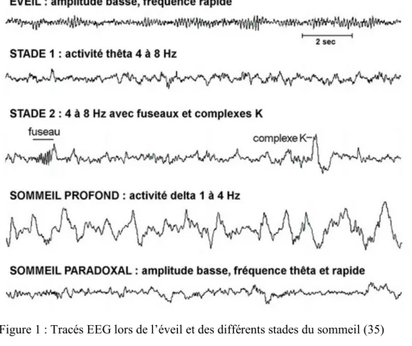 Figure 1 : Tracés EEG lors de l’éveil et des différents stades du sommeil (35) 