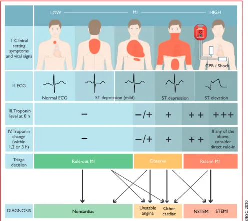 Figure 1 Diagnostic algorithm and triage in acute coronary syndrome. The initial assessment is based on the integration of low likelihood and/or high likelihood features derived from the clinical setting (i.e