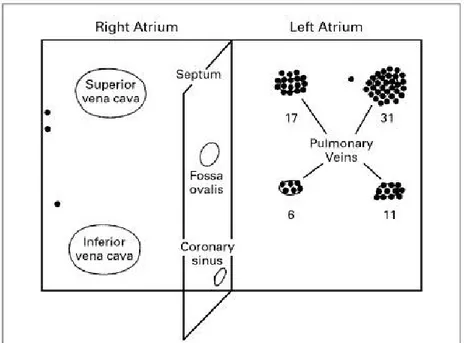 Figure 6. Diagramme de foyers électriques ectopiques déclenchant la fibrillation atriale