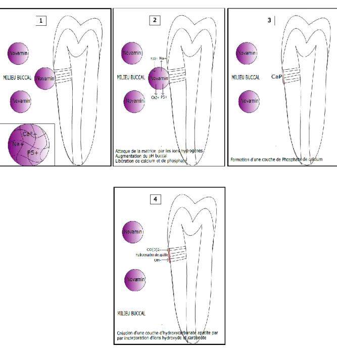 Figure 8 : Oblitération des tubuli dentinaires par la technologie Novamin  Source : Auteur 