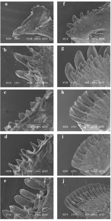 Figure 6. Comparison between the teeth of larvae (a, b, c, d, e) and adults (f, g, h, i, j); in Chromis viridis (a, f); Dascyllus flavicaudus (b, g); Chrysiptera glauca (c, h); Pomacentrus pavo (d, i);