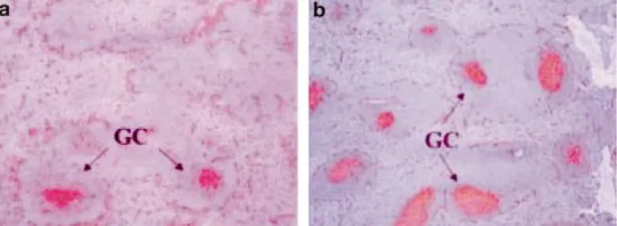 Fig. 2 - Immunostaining of PNA-positive cells in splenic cryosections: 16 days after injection, mice injected with PBS (a) dis- dis-play fewer and smaller germinal centres (GC) than mice injected with coding or non-coding plasmid (b)