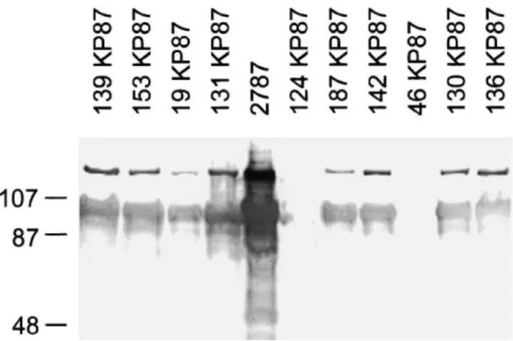 Fig. 2. Western blotting results on porcine E. coli isolates with an anti-AIDA immunserum (Benz and Schmidt, 1992)