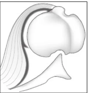 Figure   3   :   Schéma   du   mécanisme   d'apparition      de   l'encoche   humérale   postérieure