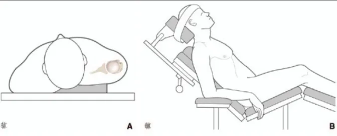 Figure   7   :   A,   B.   Installation   en   position   demi-­‐assise   avec   un   appui   le   long   du   bord   spinal   de   la   scapula   pour    l'horizontaliser