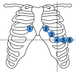 Figure n°3 : Positionnement des électrodes 