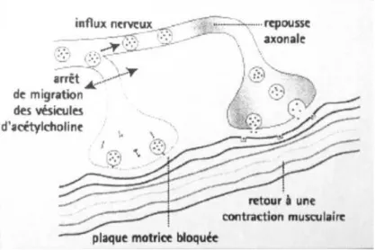 Figure 8 : Schéma de la repousse axonale. In Ranoux et Gury, Solal 2002 (9). 