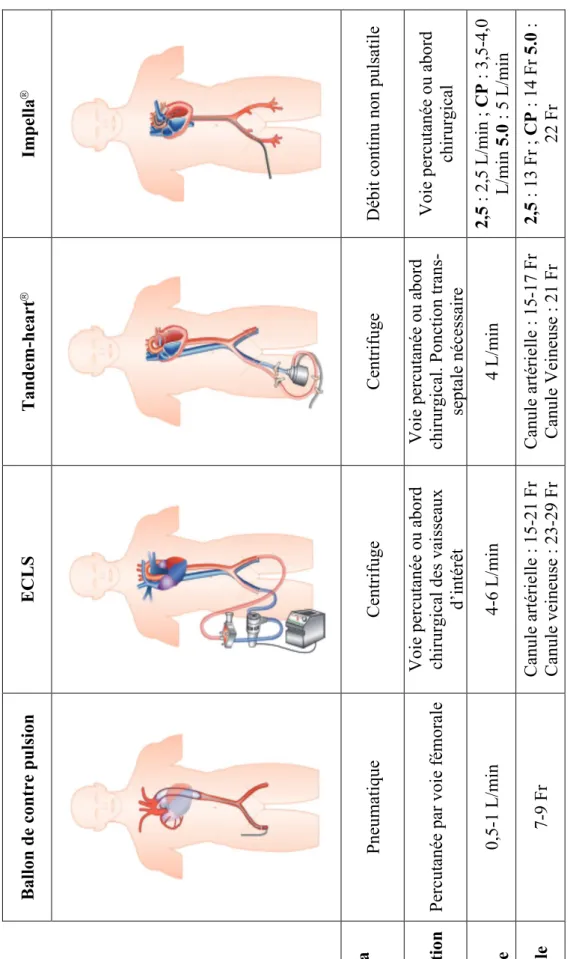 Figure 5 : Types d’assistances ventriculaires de courte durée   Ballon de contre pulsion ECLS  Tandem-heartImpella Mécanisme de la  pompe Pneumatique Centrifuge Centrifuge Débit continu non pulsatile  Technique d’insertion Percutanée par voie fémoraleVoi