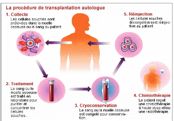 Figure 8 : Procédure de transplantation autologue (F8) 