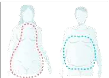 Illustration des obésités androïdes et gynoïdes 