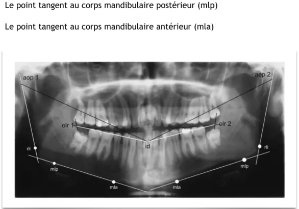 Figure 5:  Analyse radiologique selon Begtrup 2012 7 Afin de réaliser les mesures de:  