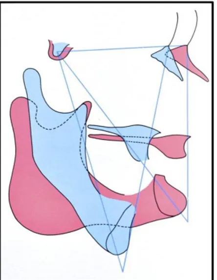 Figure 13: Direction de croissance mandibulaire, en  rotation postérieure (bleu) et en rotation antérieure 