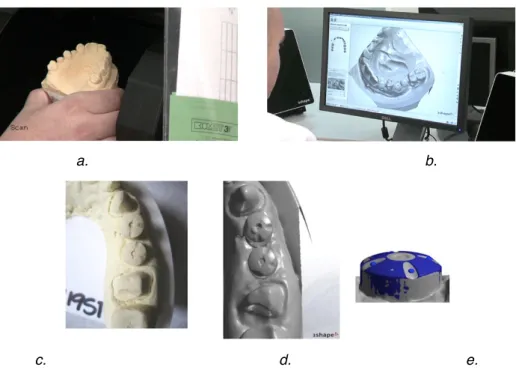 Figure 36: Exemple de numérisation extra-orale en « CFAO indirecte » au centre de production BellaTek TM  : scannage du modèle en plâtre  grâce au scanner extra-oral de laboratoire 3Shape (a et c) et visualisation 3D sur ordinateur de l’arcade (b et d) et 