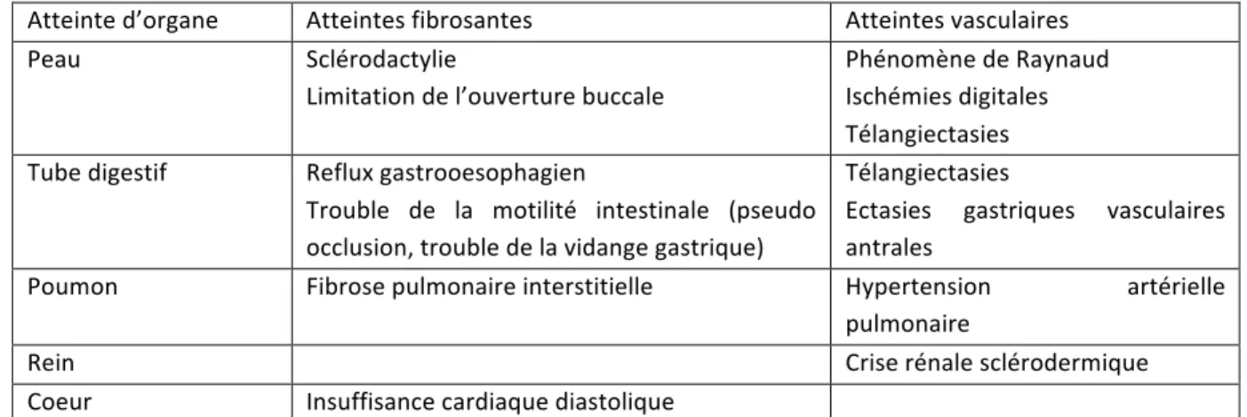 Tableau 1 : Principales atteintes d’organes de la sclérodermie systémique 