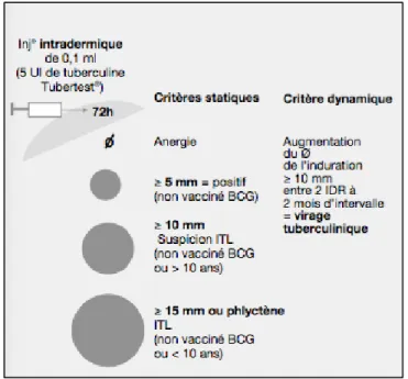 Figure 12 : interprétation de l'IDR chez l'immunocompétent. 