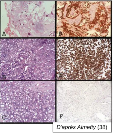 Figure 14 : présentation 