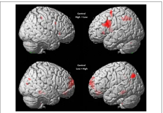 Figure 3. Univariate results for the high versus low attentional control contrasts in the verbal WM task, rendered on a standard 3-D brain template (display threshold: p &lt; .001 uncorrected).