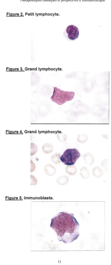 Figure 2.  Petit lymphocyte. 