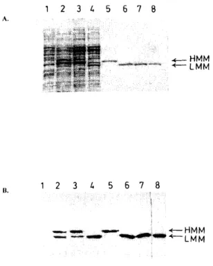 Fig. 2. Coomassie staining of the gel (A) and immunoblot (B) after SDS-PAGE of the following samples: (1)  Supernatant of lysozyme-treated E