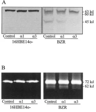 Figure 4.Processing of MMP-2 to its active form is correlated with presence of the 45-kd form of MT1-MMP