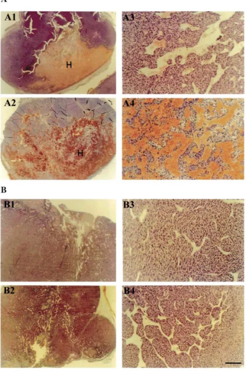 Fig. 3: H&amp;E staining of EF43.fgf-4.C and EF43.fgf-4.timp-2 tumors. Representative tumors obtained after  injection of 5 x 10 5  EF43.fgf-4.C cells (A) and EF43.fgf-4.timp-2 cells (B)