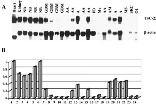 Fig. 2. Expression of TSC-22 mRNA in normal human tissues and in brain tumors. A: Northern blot hybridization of 32 P-labeled ICRFp507J1041 cDNA probe with total RNA from: lane 1, adult heart; lane 2, adult kidney; lanes 3 –6, samples of adult normal brain