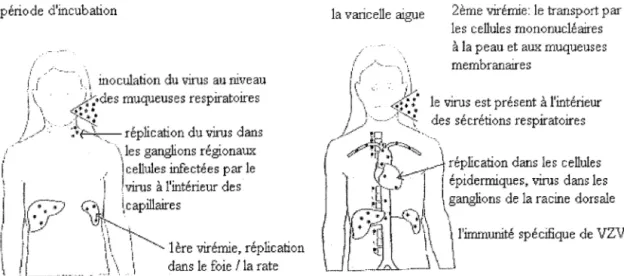 Figure n° 6.  La première infection de la varicelle. «D'après Varicella-zoster virus» [ 4]