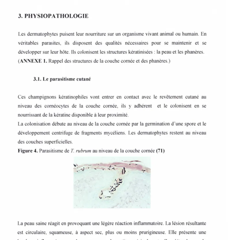 Figure 4. Parasitisme de T  rubrum  au niveau de la couche cornée (71) 