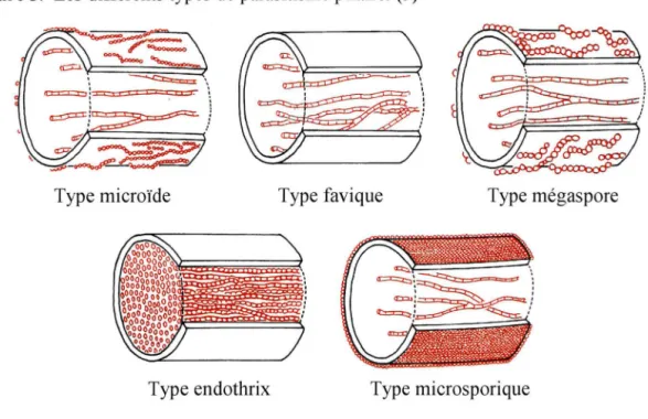 Figure 5.  Les différents types de parasitisme pilaire.  (3) 