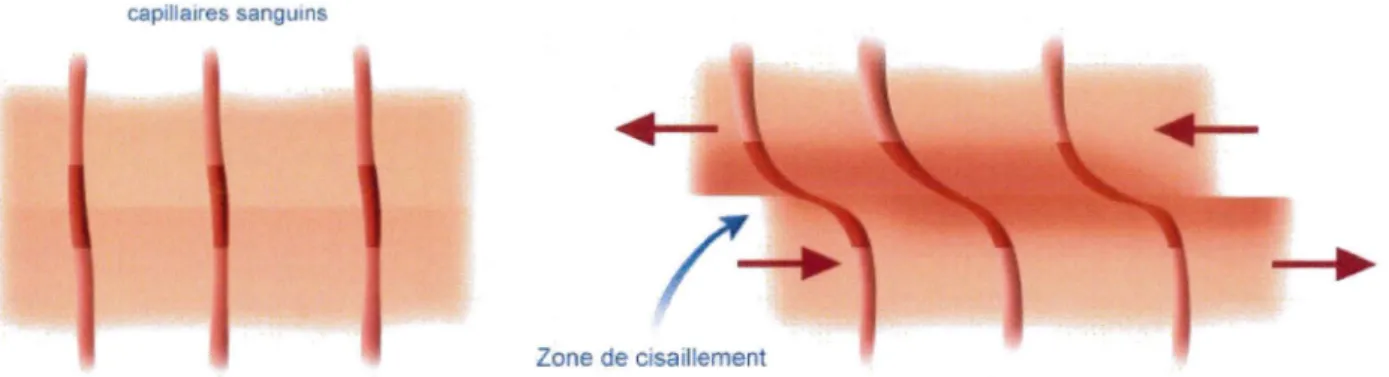 Figure 6 : Visualisation d'une zone de cisaillement 