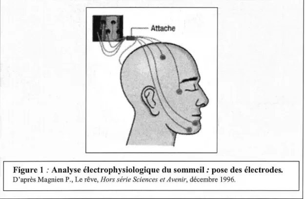 Figure 1 : Analyse électrophysiologique du sommeil : pose des électrodes. 
