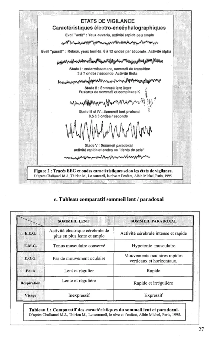 Tableau 1 : Comparatif des caractéristiques du sommeil lent et paradoxal. 