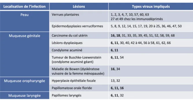 Tableau 1 : Lésions cutanéo-muqueuses et génotypes viraux associés 