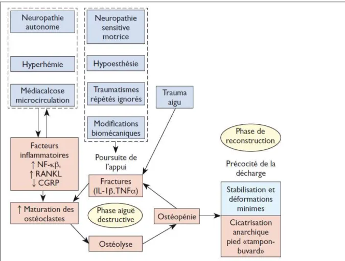 Figure 4 : Pathophysiologie de l’ostéoarthropathie diabétique (issu de (17)) 