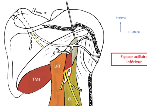 Figure 14 : Passage du nerf radial dans l'espace axillaire inférieur sur une vue postérieure