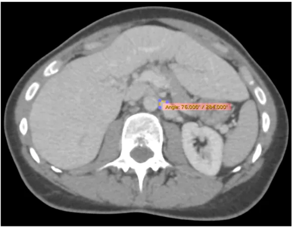 Figure 2. Angle du bec 