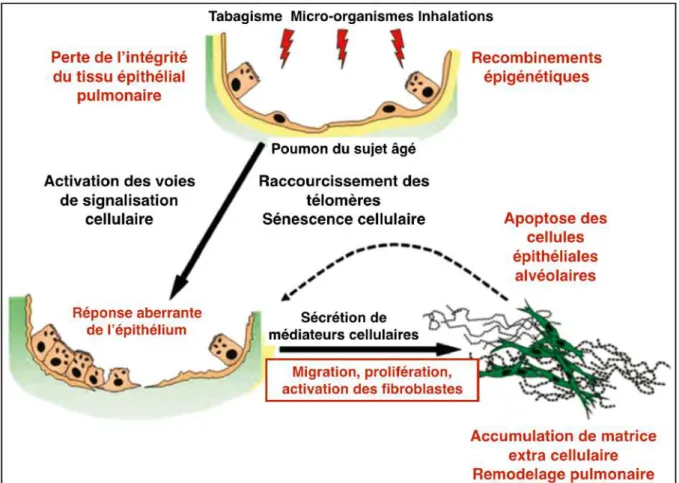 Figure  2 :  Modèle  cellulaire  impliqué  dans  la  pathogenèse  de  la  fibrose  pulmonaire  idiopathique