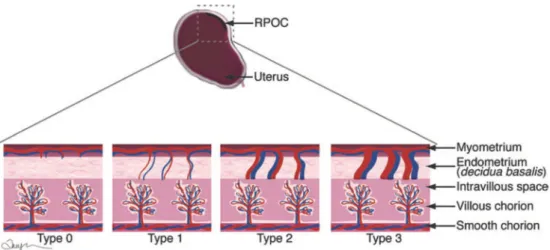 Figure 6 : Schéma illustrant les RPOC en fonction des types de vascularisation  (type 0 à 3)