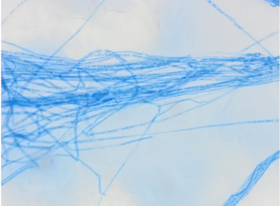 Figure 6 : Filaments (hyphes ou hyphae) de Fusarium colorés au bleu de lactophenol. Grossissement x400  Remarquez les cloisons ou septa au sein des filaments