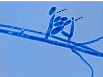 Figure 8 : Fusarium oxysporum observé au microscope optique en contraste de phase. 