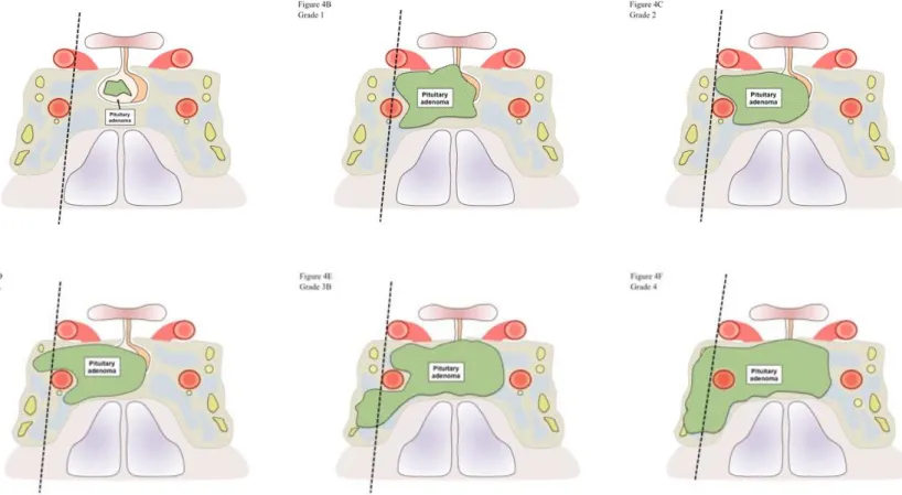 Figure 6 : Schématisation de la classification de KNOSP. 